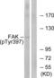 Protein Tyrosine Kinase 2 antibody, LS-C117354, Lifespan Biosciences, Western Blot image 