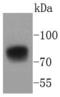 Trophoblast glycoprotein antibody, A07442, Boster Biological Technology, Western Blot image 