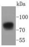 Trophoblast Glycoprotein antibody, A07442, Boster Biological Technology, Western Blot image 