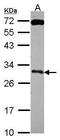 Kallikrein Related Peptidase 10 antibody, PA5-30131, Invitrogen Antibodies, Western Blot image 