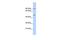 Potassium Voltage-Gated Channel Subfamily J Member 8 antibody, GTX47687, GeneTex, Western Blot image 