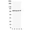 Potassium Voltage-Gated Channel Subfamily A Member 4 antibody, R31421, NSJ Bioreagents, Western Blot image 