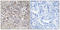 Claudin 6 antibody, LS-C119859, Lifespan Biosciences, Immunohistochemistry paraffin image 