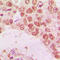 Histone Deacetylase 10 antibody, LS-C353583, Lifespan Biosciences, Immunohistochemistry frozen image 