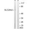 Solute Carrier Family 28 Member 2 antibody, A07211, Boster Biological Technology, Western Blot image 