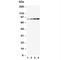 Phosphoinositide-3-Kinase Regulatory Subunit 1 antibody, R30480, NSJ Bioreagents, Western Blot image 