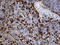 Junction Plakoglobin antibody, LS-C796353, Lifespan Biosciences, Immunohistochemistry paraffin image 