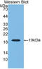 Renalase, FAD Dependent Amine Oxidase antibody, LS-C314936, Lifespan Biosciences, Western Blot image 