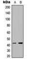 RNA Binding Motif Protein X-Linked antibody, LS-C358272, Lifespan Biosciences, Western Blot image 