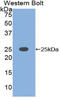 C-Type Lectin Domain Family 4 Member C antibody, LS-C293565, Lifespan Biosciences, Western Blot image 