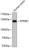 Protein Phosphatase 6 Regulatory Subunit 1 antibody, 19-402, ProSci, Western Blot image 