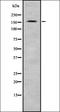 CF Transmembrane Conductance Regulator antibody, orb336495, Biorbyt, Western Blot image 