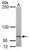 Proteasome 26S Subunit, Non-ATPase 2 antibody, GTX102289, GeneTex, Western Blot image 