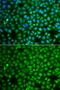 Zinc Finger Protein 346 antibody, GTX65857, GeneTex, Immunofluorescence image 