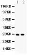 Linker For Activation Of T Cells antibody, LS-C313273, Lifespan Biosciences, Western Blot image 