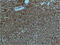 Phosphoinositide-3-Kinase Regulatory Subunit 1 antibody, GTX34123, GeneTex, Immunohistochemistry paraffin image 