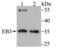 Microtubule Associated Protein RP/EB Family Member 3 antibody, A05782-1, Boster Biological Technology, Western Blot image 