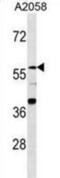 Zinc Finger Protein 776 antibody, abx030234, Abbexa, Western Blot image 