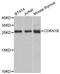 Cyclin Dependent Kinase Inhibitor 1B antibody, LS-C330905, Lifespan Biosciences, Western Blot image 