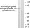 Sodium Channel Epithelial 1 Beta Subunit antibody, GTX00671, GeneTex, Western Blot image 