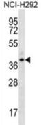 Olfactory Receptor Family 5 Subfamily I Member 1 antibody, abx027006, Abbexa, Western Blot image 
