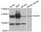 Poly(ADP-Ribose) Polymerase 1 antibody, abx126323, Abbexa, Western Blot image 