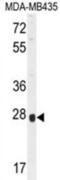 Olfactory Receptor Family 8 Subfamily B Member 4 (Gene/Pseudogene) antibody, abx026308, Abbexa, Western Blot image 