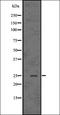 Casein Kinase 2 Beta antibody, orb336644, Biorbyt, Western Blot image 