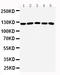 Suppression Of Tumorigenicity 5 antibody, LS-C313379, Lifespan Biosciences, Western Blot image 