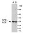 Apurinic/Apyrimidinic Endodeoxyribonuclease 1 antibody, GTX70129, GeneTex, Western Blot image 