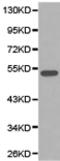 Heterogeneous Nuclear Ribonucleoprotein K antibody, TA321440, Origene, Western Blot image 