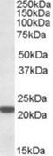 Proteasome Subunit Beta 8 antibody, NBP1-51957, Novus Biologicals, Western Blot image 