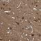 TNFRSF21 antibody, NBP1-84982, Novus Biologicals, Immunohistochemistry paraffin image 