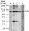 Toll Like Receptor 5 antibody, PA1-41139, Invitrogen Antibodies, Western Blot image 