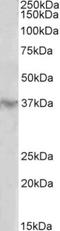 Homeobox D12 antibody, NBP2-26178, Novus Biologicals, Western Blot image 