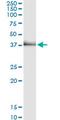 Tribbles Pseudokinase 2 antibody, MA5-24548, Invitrogen Antibodies, Immunoprecipitation image 