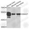 SMAD Family Member 7 antibody, A8342, ABclonal Technology, Western Blot image 