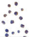 Checkpoint Kinase 2 antibody, 2391, ProSci, Immunocytochemistry image 