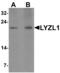 Lysozyme Like 1 antibody, MBS153434, MyBioSource, Western Blot image 