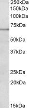 Terminal Nucleotidyltransferase 4B antibody, EB10938, Everest Biotech, Western Blot image 