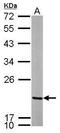 Mitochondrial Ribosomal Protein L12 antibody, GTX114731, GeneTex, Western Blot image 