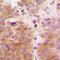 Mitogen-Activated Protein Kinase Kinase Kinase 7 antibody, LS-C356178, Lifespan Biosciences, Immunohistochemistry paraffin image 