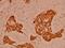Catenin Alpha 1 antibody, PA5-36046, Invitrogen Antibodies, Immunohistochemistry paraffin image 