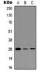 B Cell Receptor Associated Protein 31 antibody, LS-C354559, Lifespan Biosciences, Western Blot image 