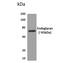 Podocalyxin Like 2 antibody, NBP2-12273, Novus Biologicals, Western Blot image 