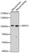 Adenylate Cyclase 1 antibody, 23-902, ProSci, Western Blot image 