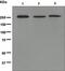 Acetyl-CoA Carboxylase Beta antibody, ab109368, Abcam, Western Blot image 