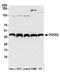 Programmed Cell Death 2 antibody, NBP2-04042, Novus Biologicals, Western Blot image 