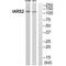 Isoleucyl-TRNA Synthetase 2, Mitochondrial antibody, A09580, Boster Biological Technology, Western Blot image 