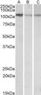 Structural Maintenance Of Chromosomes 2 antibody, 42-394, ProSci, Enzyme Linked Immunosorbent Assay image 